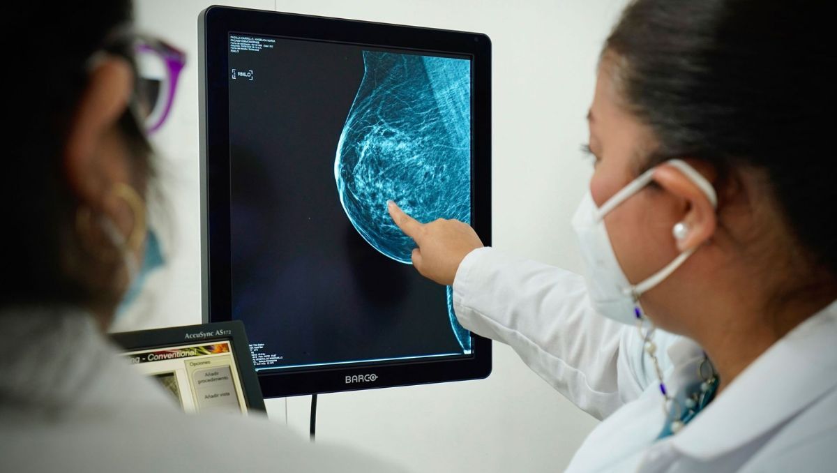 Tumores de cáncer de mama en México ‘crecen’ más rápido, especialistas parecen haber encontrado la razón