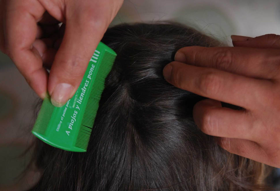 La única forma de contagio de la pediculosis es por contacto directo