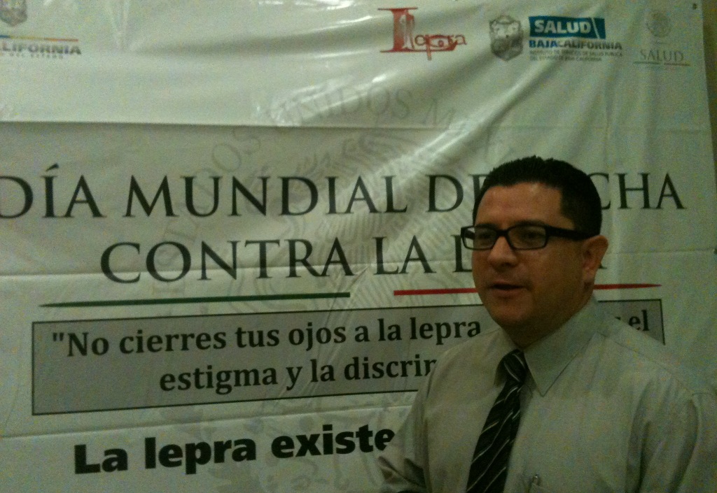 Lepra