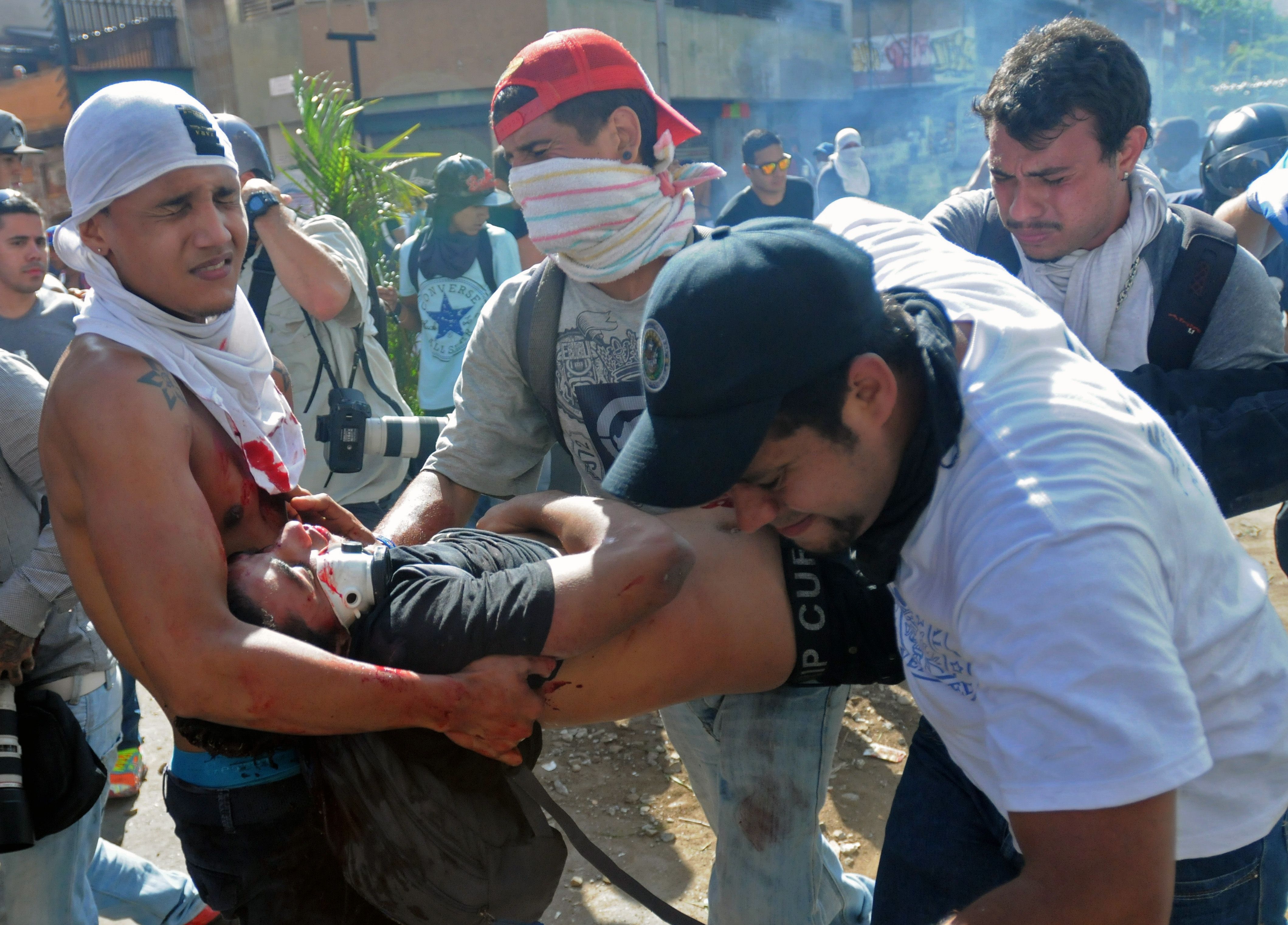 El estudiante Bassil DaCosta, es ayudado tras ser herido en la manifestación de hoy en Caracas, aunque después fallecería