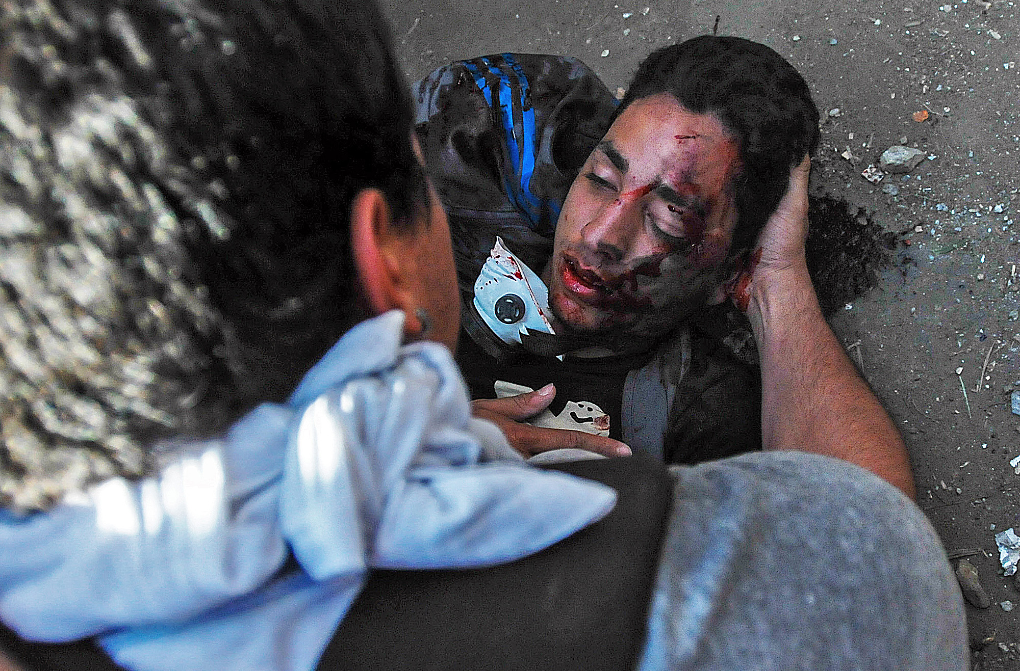 Bassil DaCosta, uno de los dos fallecidos el miércoles es ayudado tras ser herido en la marcha opositora en Caracas