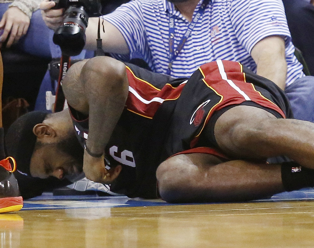 Duro golpe a James en la naríz