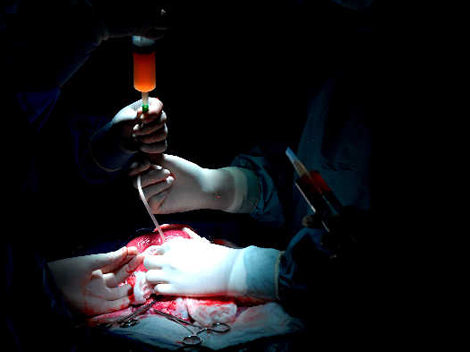 En dos años de labor, Medicina Fetal México ha realizado cirugía fetal en pulmones, corazón y vías urinarias