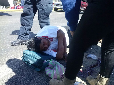Uno de los manifestantes fue atropellado durante la marcha. 