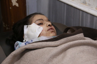 Una niña siria herida en el ataque a la escuela Ain Jalout, en el distrito de Ansari, en Alepo, descansa en la cama de un hospital  