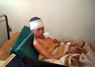 Un joven sirio herido en la explosión de un coche bomba, en la cama de un hospital de la ciudad de Hama 