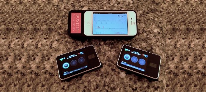 iPhone modificado combate con eficacia la diabetes. El "Páncreas biónico" se conecta con una aguja en el paciente y mantiene los niveles de azúcar en 
