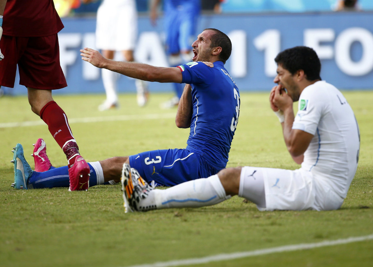 Chiellini muestra la 'mordida' que Luis Suárez le propinó, mientras el uruguayo se 'duele' de los dientes 