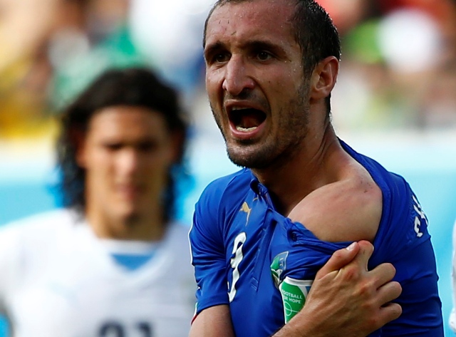 Giorgio Chiellini muestra las marcas de las mordidas de Luis Suárez 