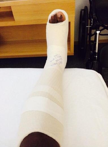 La pierna de Onazi después de la revisión médica 