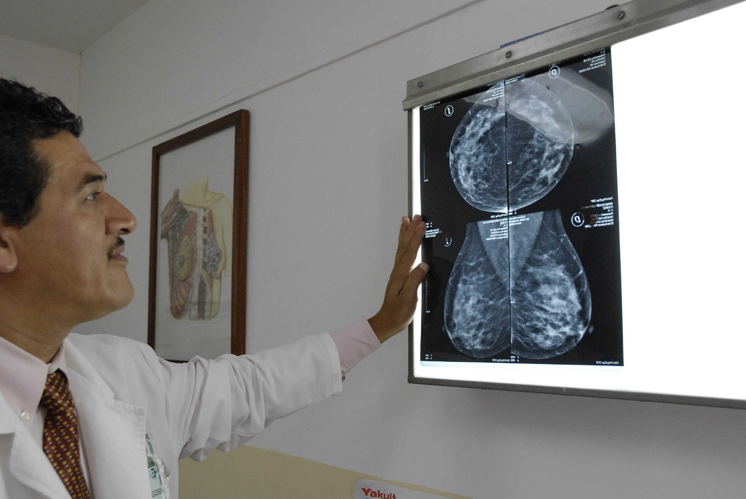 Las revisiones anuales son imprescindibles en la prevención del cáncer