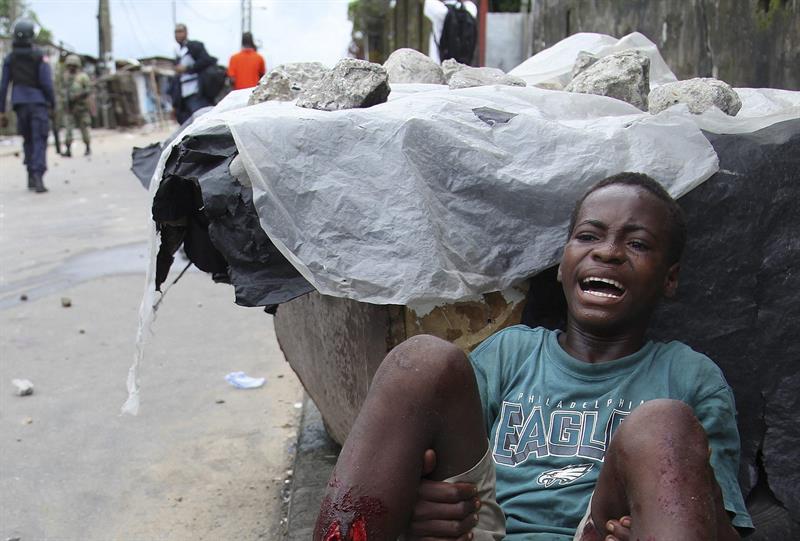 Shakie Kamara, de 15 años, que en la foto del 20 de agosto llora tras recibir disparos en las piernas de la policía liberiana, ha muerto hoy
