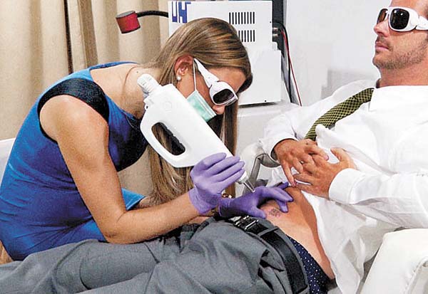 Se debe acudir a ocho sesiones para eliminar toda la tinta.