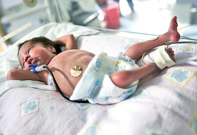 Cada año ingresa un promedio de 600 bebés a la Unidad de Cuidados Intensivos Neonatales Externos del HCG. 