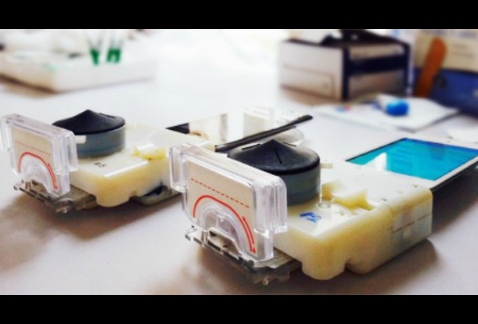 Los aparatos se conectan a un celular o computadora para saber si los pacientes tienen sida o sífilis.