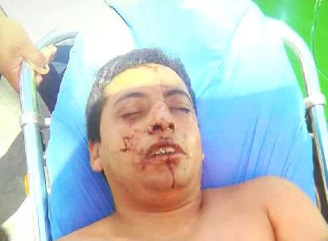 Erasmo González, presunta víctima de los uniformados.