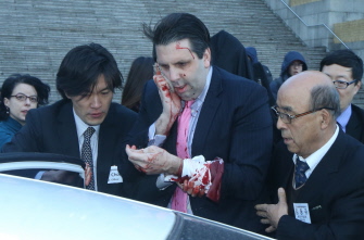 El embajador de EU en Corea del Sur, Mark Lippert (c), se cubre la herida en su cara al abandonar el Instituto Cultural Sejong, ayer en Seúl