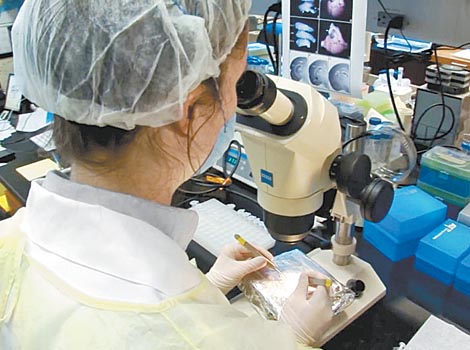 La sustancia, llamada 3BNC117, actúa neutralizando el VIH.