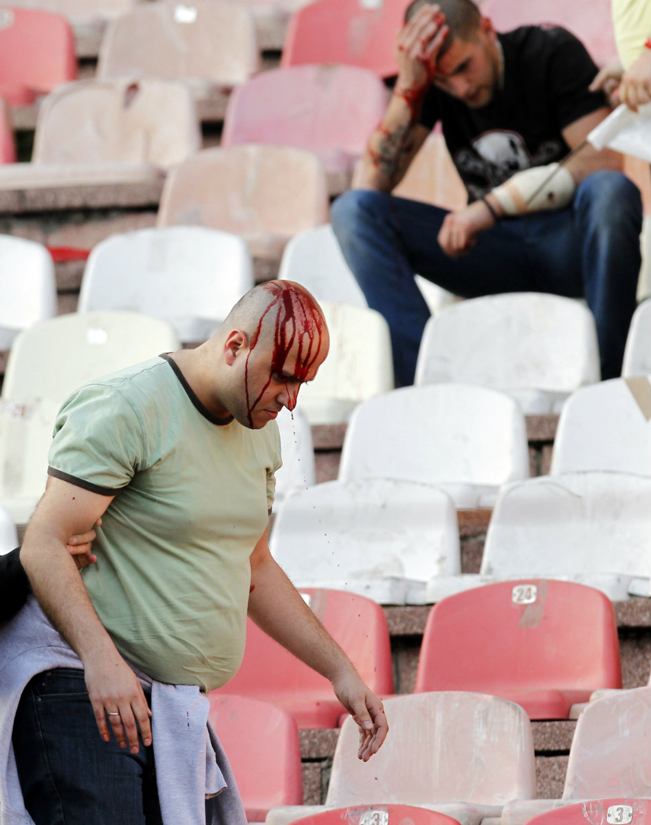 El derbi de Serbio se manchó de rojo