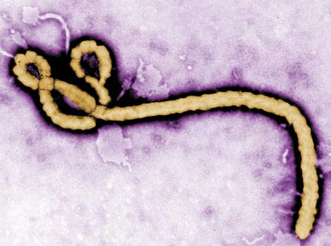 La epidemia causada por el virus ha dejado al menos más de 11 mil muertos y 27 mil infectados.