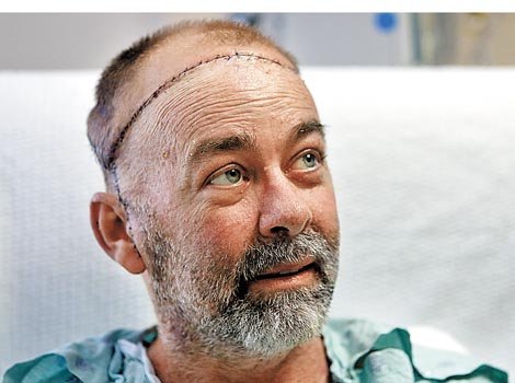 Jim Boysen, desarrollador de software, de 55 años, padece diabetes.