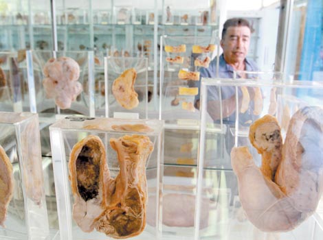 Exhiben disecciones de pulmones, corazones, intestinos, cerebros, mamas, fetos, pies y manos.