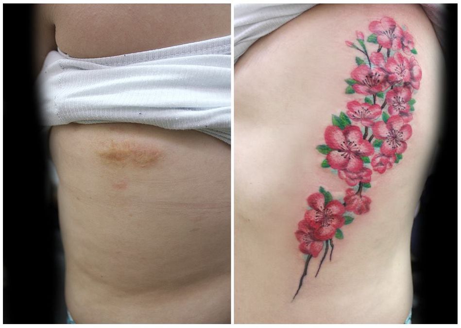 Desde hace dos años, cubre las heridas con sus propios diseños. En este caso, hizo unas flores de cerezo para tapar la herida del balazo que una mujer