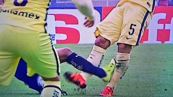 Javier Güémez  presentó fractura de tibia tras esta entrada de Cortés 