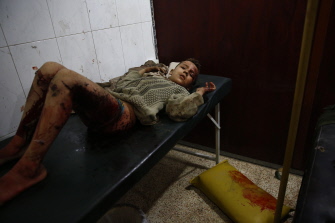 Un niño herido en un bombardeo de la aviación siria en Hamuriyé, en la región de Guta, en las afueras de Damasco, espera a ser tratado