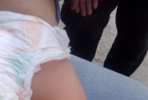 El bebé sufrió diversas mordeduras presuntamente por otro menor. 