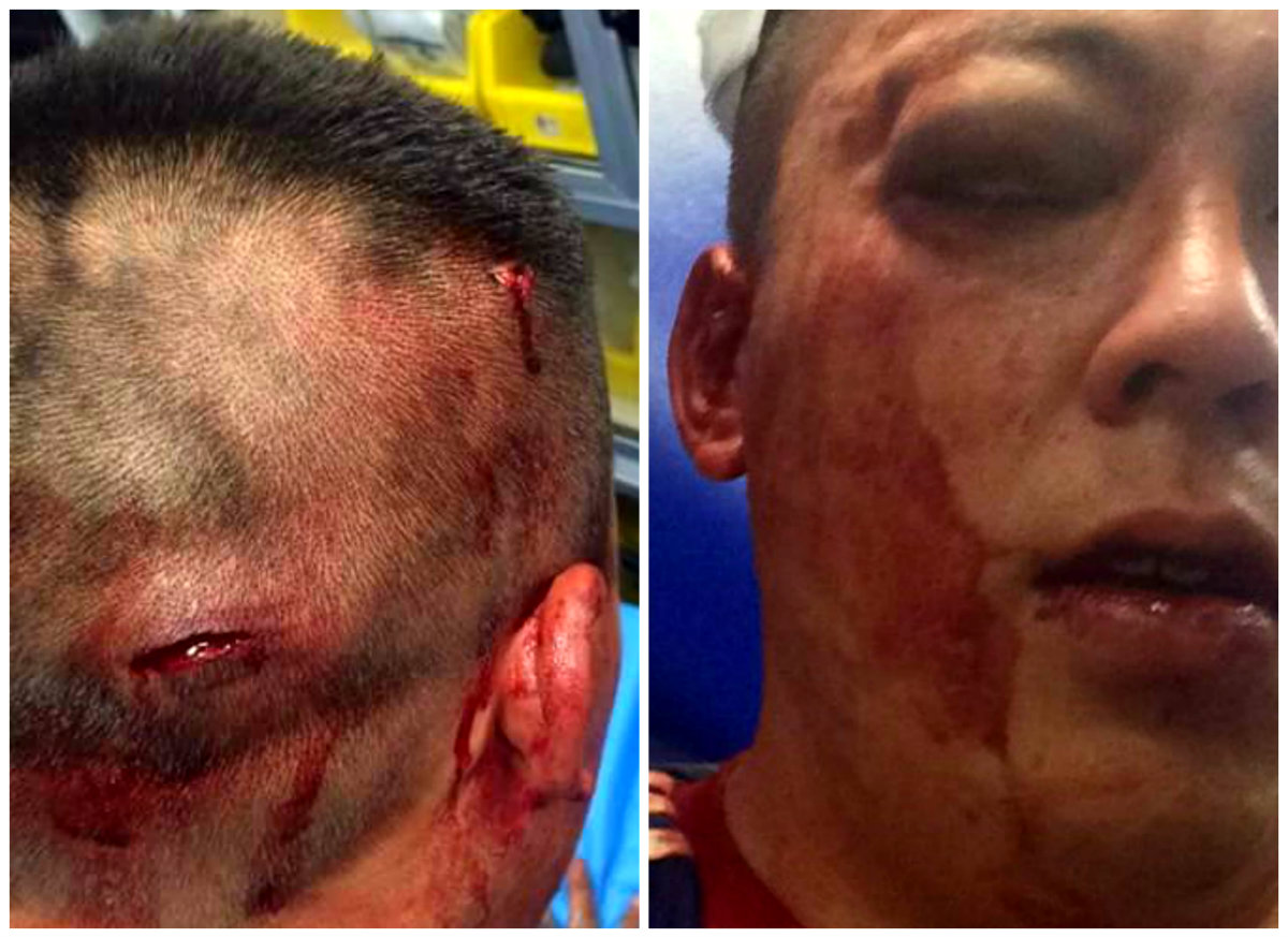 El fan lesionado que solicitó el anonimato 