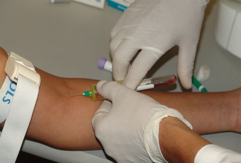 La Jurisdicción Sanitaria Número VI con sede en Torreón, adelantó el festejo del Día Mundial del Donante de Sangre 2016.
