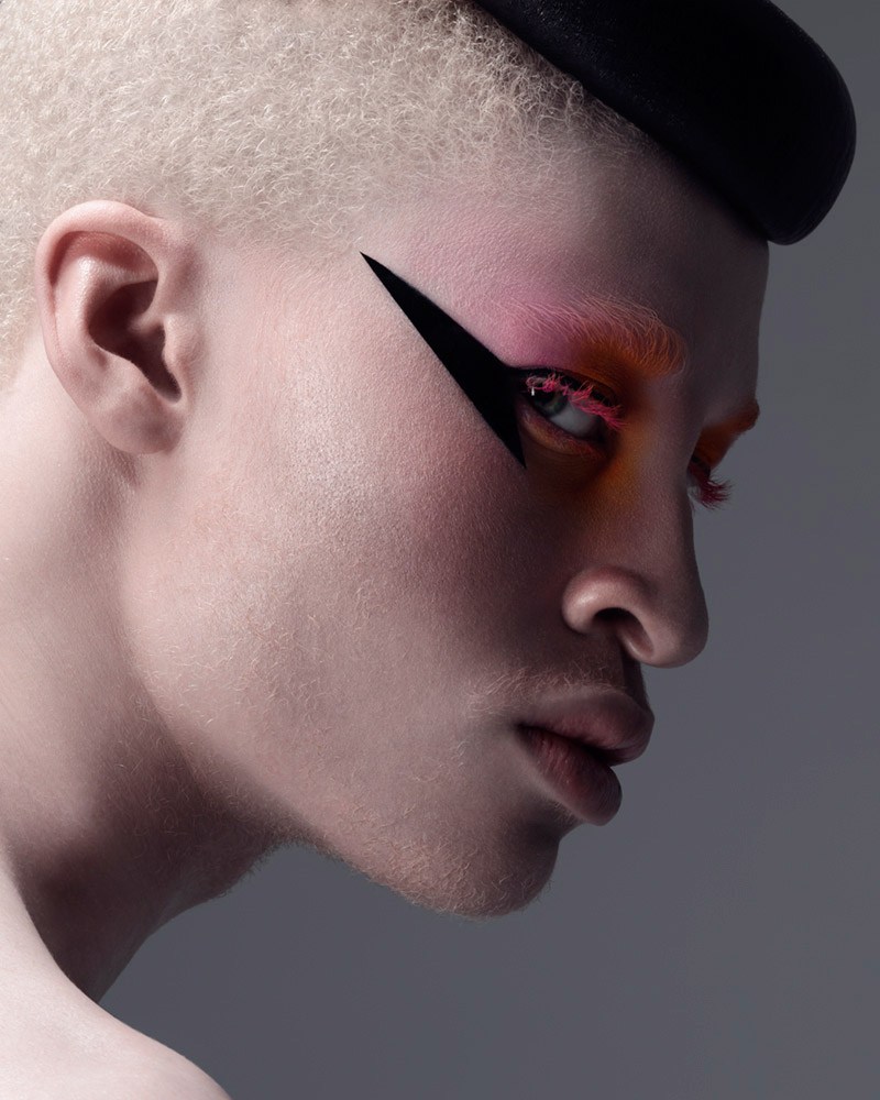 El modelo estadunidense Shaun Ross es conocido por ser el primer modelo albino profesional. Ha modelado para Alexander McQueen y ha aparecido en la po