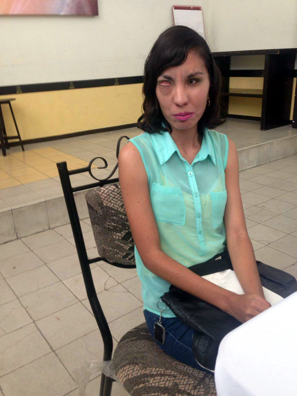 Se requieren 37 mil pesos para retirarle el tumor en la órbita.