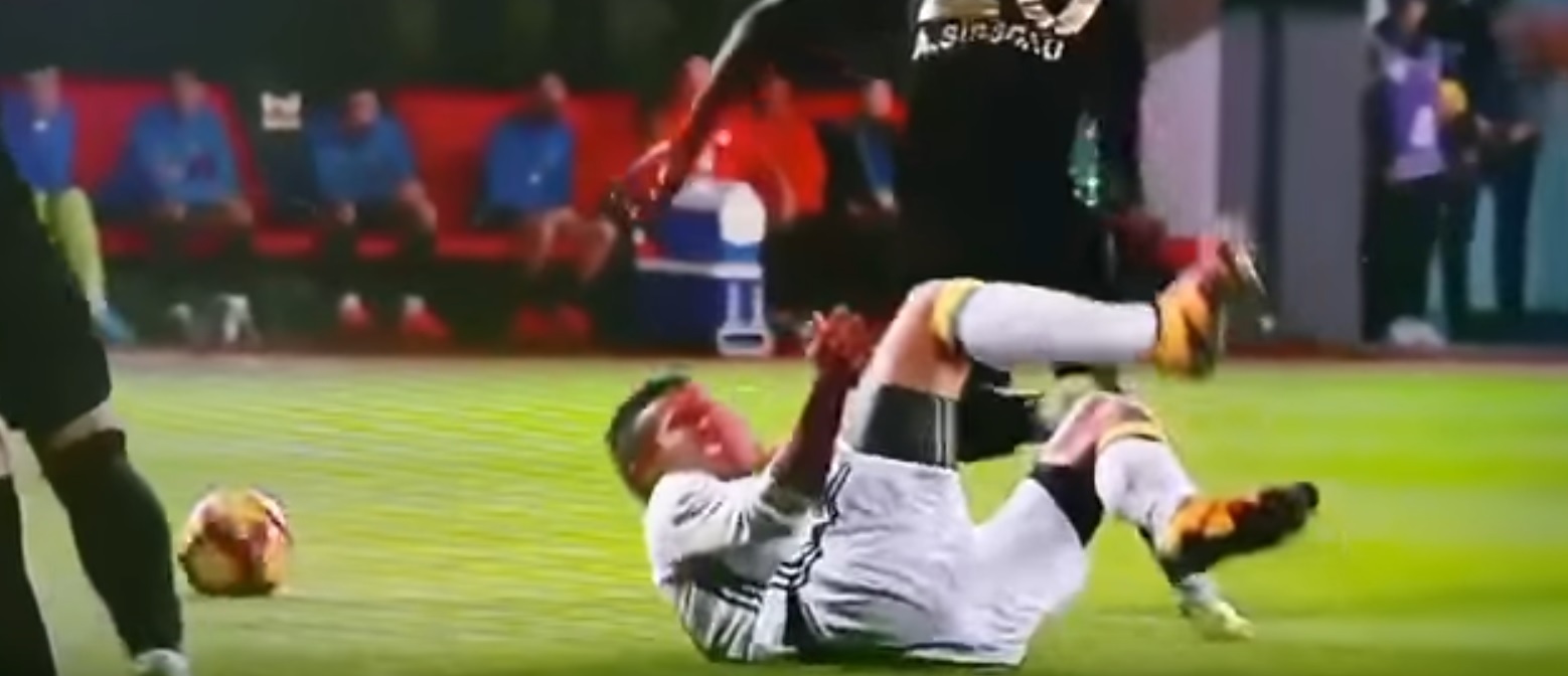 Van Persie lleva su mano a la zona afectada 