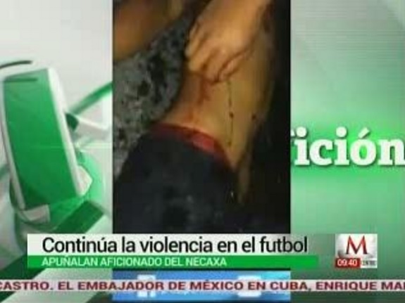 Aficionado del Necaxa que resultó herido al término del duelo ante Pachuca en la vuelta de los Cuartos de Final 