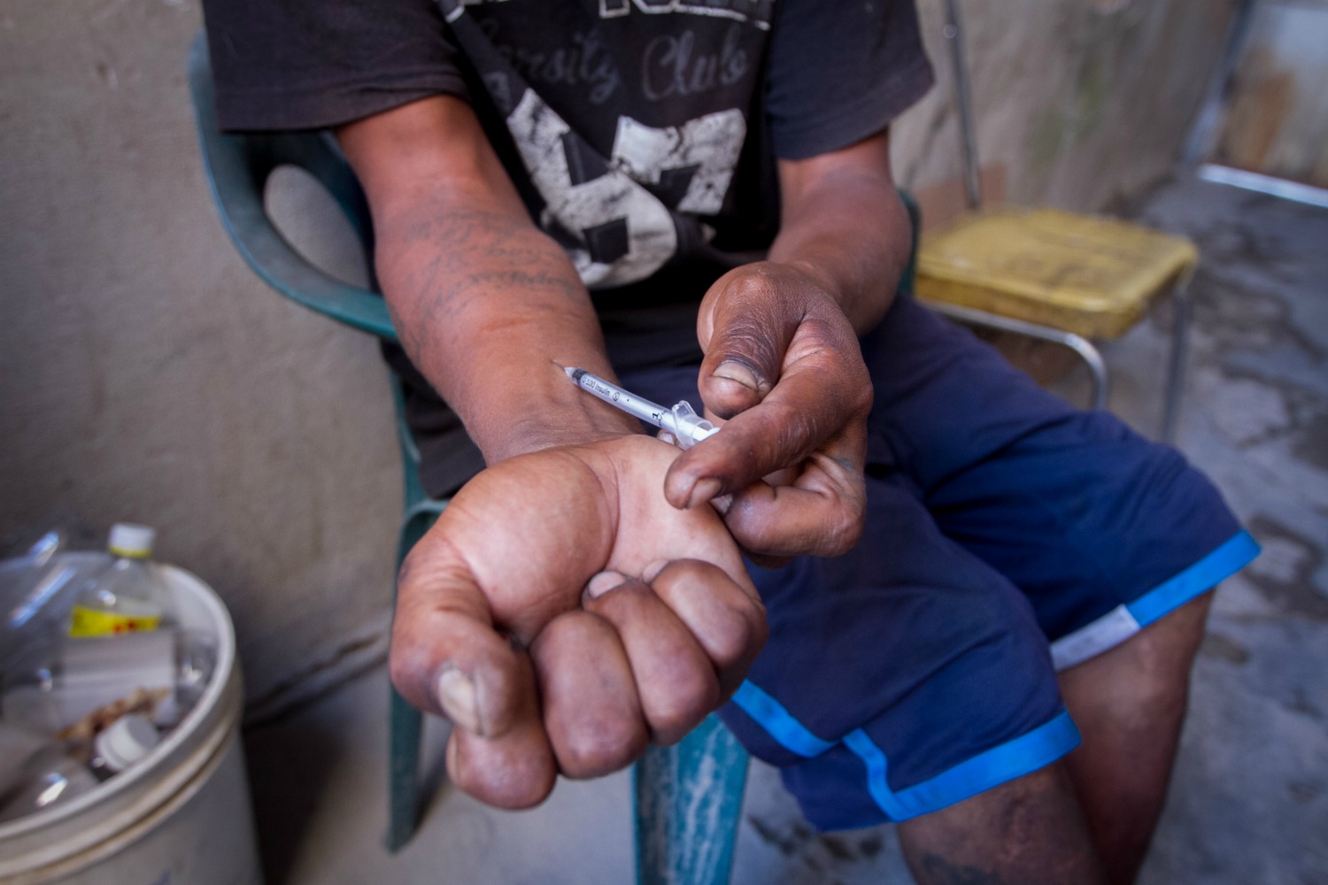 En brazos y piernas, César tiene tatuadas las huellas de su adicción.