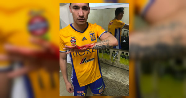 Así quedó el brazo de Dueñas