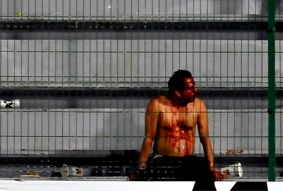 Un fanático herido después de la violencia que se desató en el Luis ‘Pirata’ Fuente