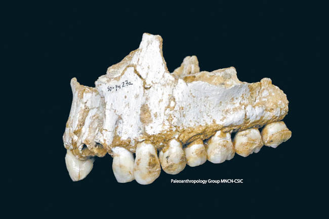 Secuenciaron el material genético del sarro bacteriano calcificado en los dientes de cuatro fósiles. 