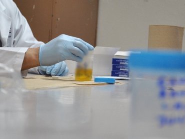 Prueba de dopaje.