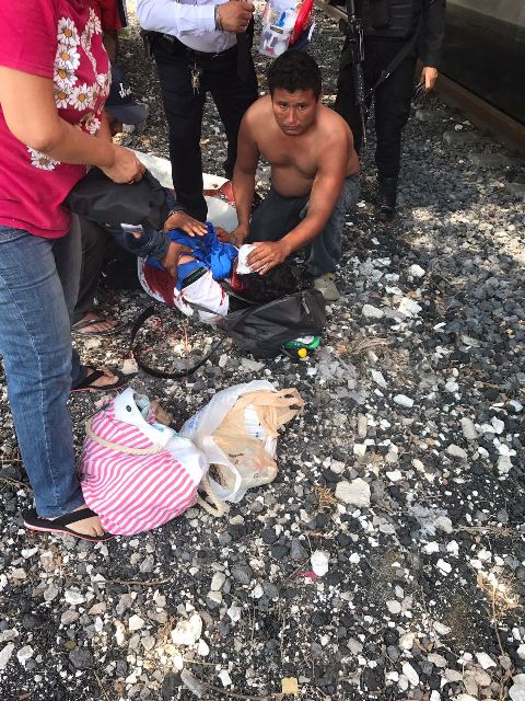 Tren amputa mano a estudiante del Conalep