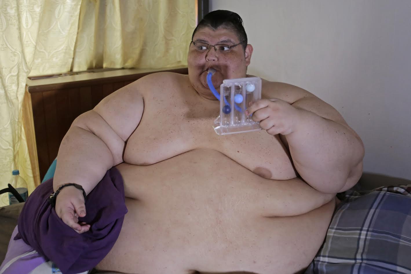 Juan Pedro es considerado como el hombre más obeso del mundo
