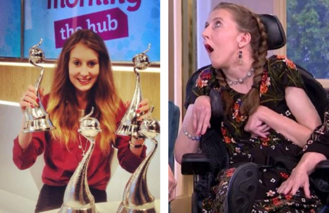 La productora de TV Amy May Shead, antes y después de la reacción alérgica.