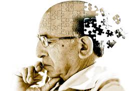 El  Alzheimer ocurre en todo el mundo, sin preferencia de raza y su principar factor de riesgo es la edad. 