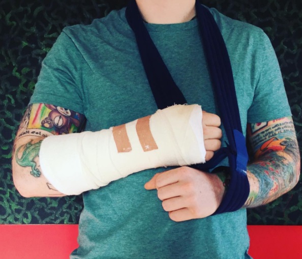 Ed Sheeran sufre accidente en bicicleta.