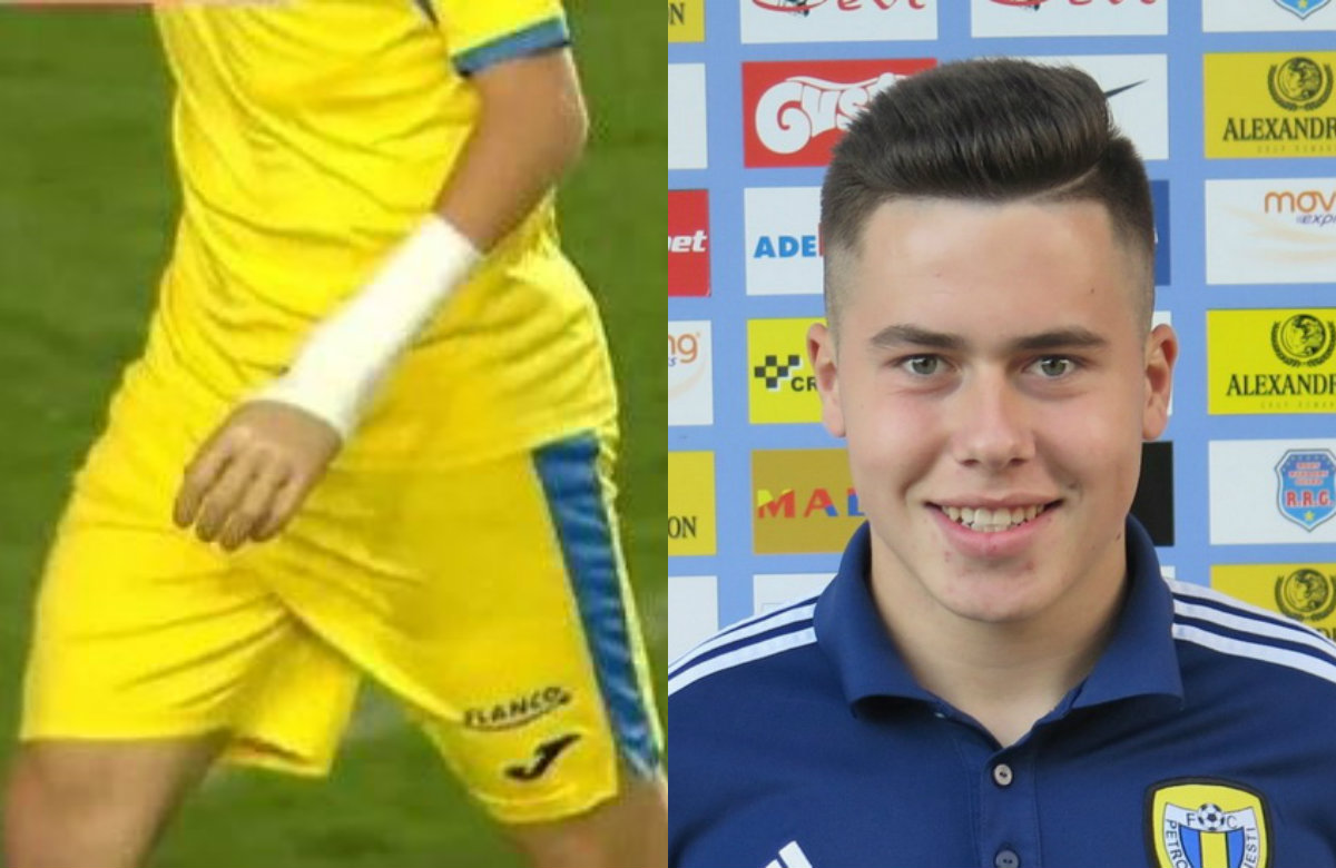 Cosmin Lambru usó una protesis durante su debut profesional