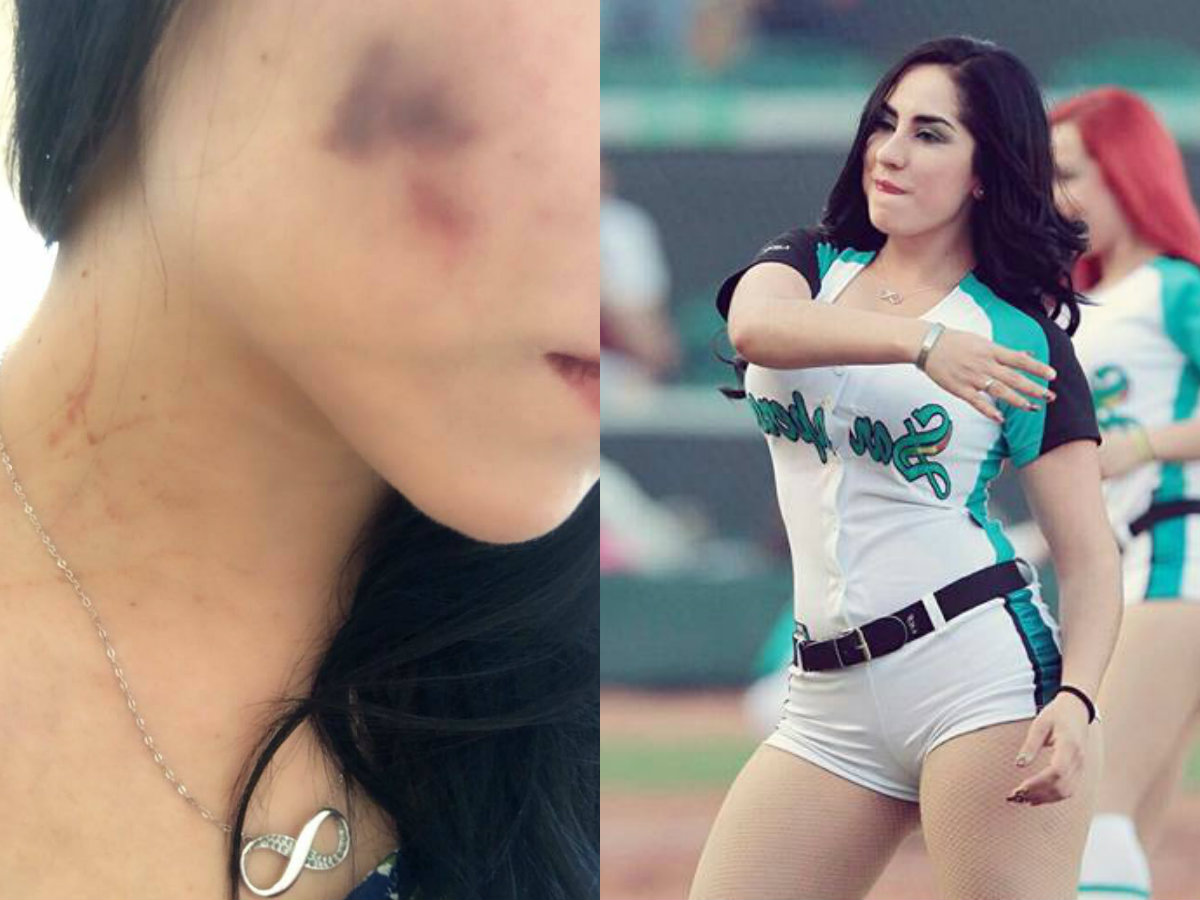 Porrista de Saraperos de Saltillo denuncia a su novio por violencia