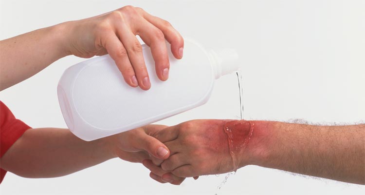 Ante accidente o lesión mayor debe trasladarse a una unidad de urgencias de inmediato.