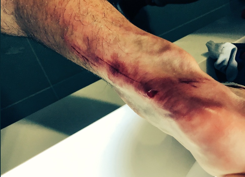 Así quedó la pierna de Rodolfo Pizarro tras el partido vs Santos